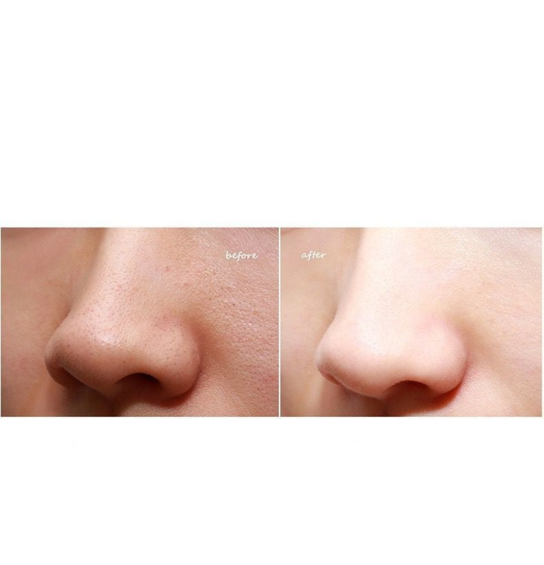HKM-266963 Electric Facial Cleansing Tool for Blackhead Removal - 450mAh Battery, High Suction Power