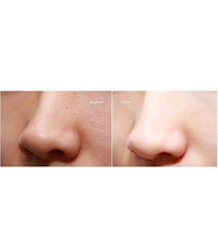 HKM-266963 Electric Facial Cleansing Tool for Blackhead Removal - 450mAh Battery, High Suction Power