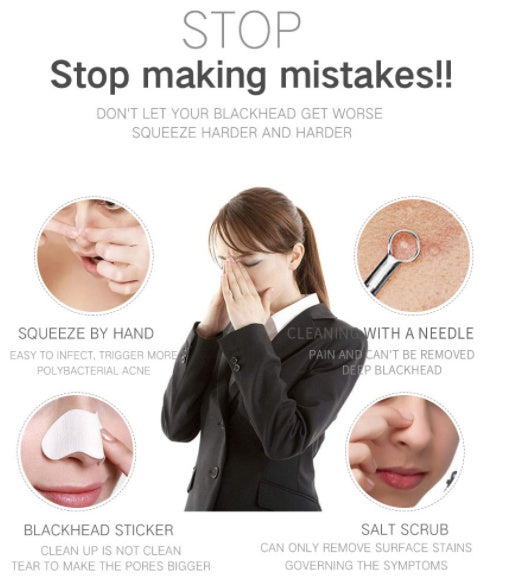 HKM-636947 Electric Blackhead Suction Device with 4 Suction Heads for Pore Cleansing and Acne Removal