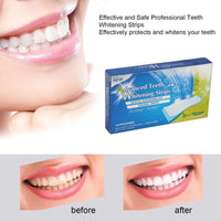 HKM-570259 Advanced Teeth Whitening Strips for Effective Stain Removal and Oral Hygiene Enhancement