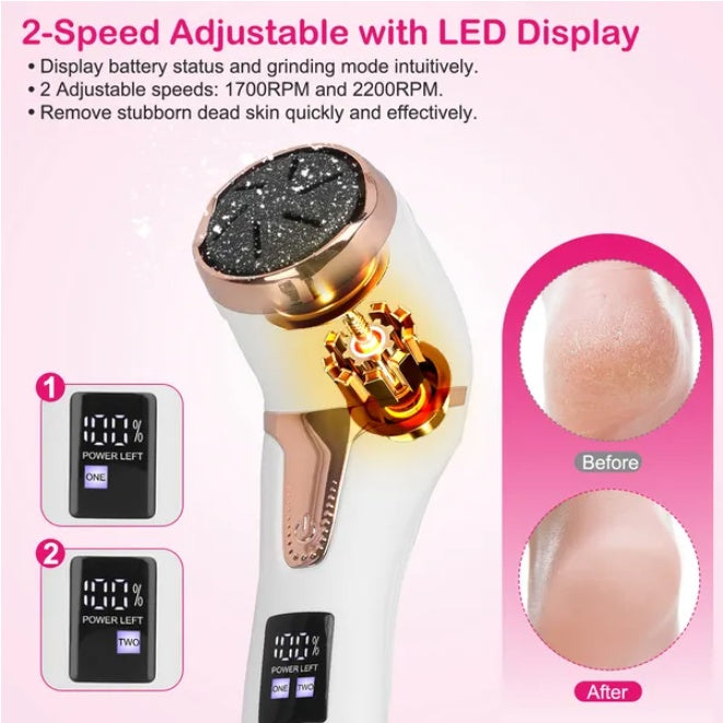 HKM-384531 17-Piece Electric Foot Callus Remover Set for Smooth and Soft Feet