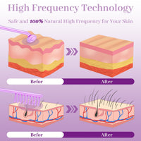 HKM-626259 High Wave Electrotherapy Rod Set for Wrinkle Removal and Skin Rejuvenation