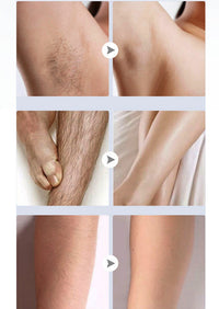 HKM-705939 Painless Electric Hair Removal Shaver for Whole Body Trimming, USB Rechargeable, Water Washable