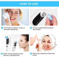 HKM-325075 Rechargeable Electric Blackhead Remover with 5 Suction Heads for Skin Tightening and Rejuvenation