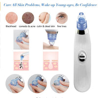 HKM-473107 Blackhead Removal Device with 3.7V Rated Voltage and 4W Power