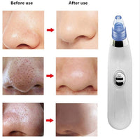 HKM-473107 Blackhead Removal Device with 3.7V Rated Voltage and 4W Power