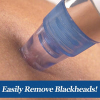 HKM-473107 Blackhead Removal Device with 3.7V Rated Voltage and 4W Power