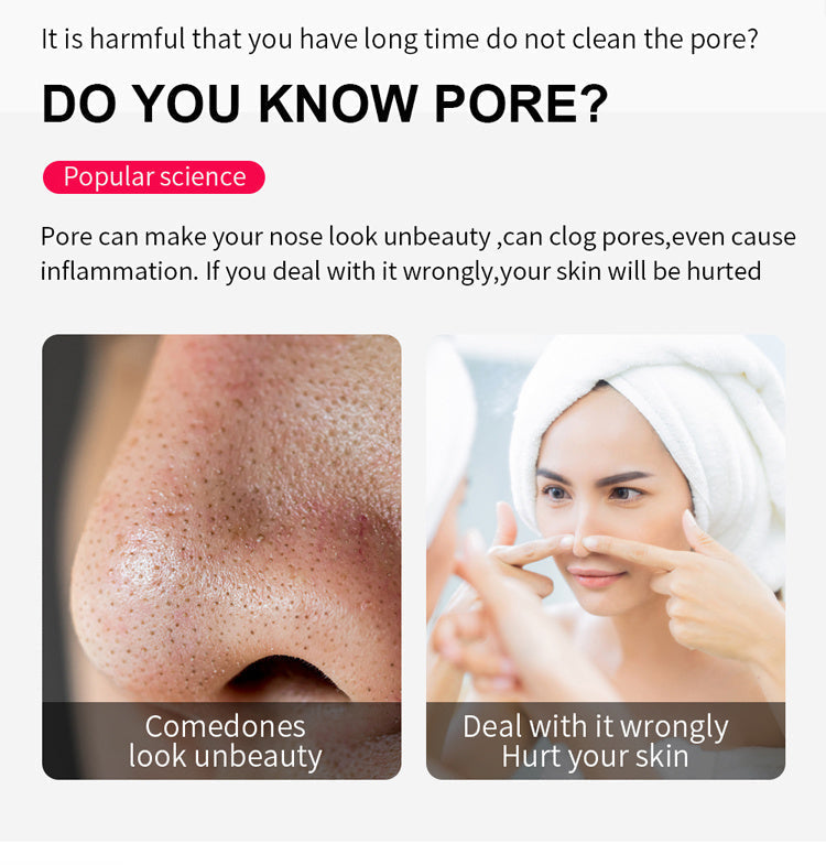 HKM-087315 Blackhead Removal Electric Suction Device for Deep Skin Cleansing
