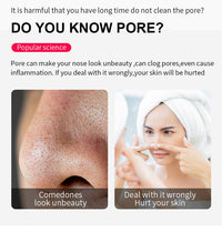 HKM-087315 Blackhead Removal Electric Suction Device for Deep Skin Cleansing