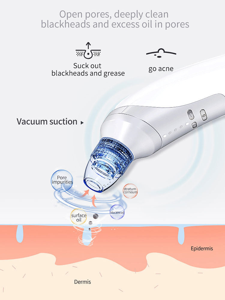 HKM-739219 Electric Blackhead Removal Device with Vacuum Suction - Includes 4 Replaceable Heads, Base Charging, and Instruction Manual