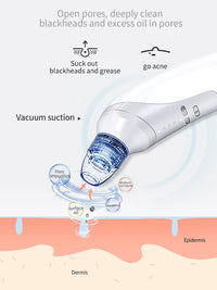 HKM-739219 Electric Blackhead Removal Device with Vacuum Suction - Includes 4 Replaceable Heads, Base Charging, and Instruction Manual