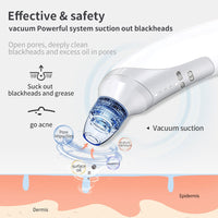 HKM-739219 Electric Blackhead Removal Device with Vacuum Suction - Includes 4 Replaceable Heads, Base Charging, and Instruction Manual
