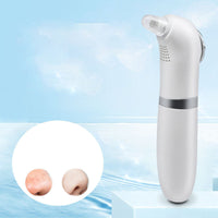 HKM-180051 Hot and Cold Blackhead Remover Cleansing Instrument with Vacuum Adsorption for Home Use