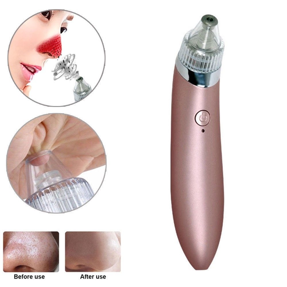 HKM-224467 Facial Blackhead Extractor with 4 Removable Heads and Adjustable Suction for Deep Cleansing
