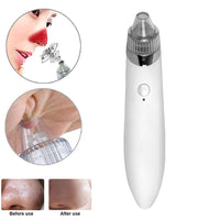HKM-224467 Facial Blackhead Extractor with 4 Removable Heads and Adjustable Suction for Deep Cleansing