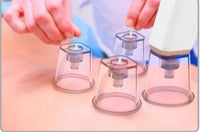 HKM-054547 Intelligent Blackhead Removal Device with Hot and Cold Cupping Feature