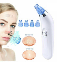 HKM-634643 Facial Pore Cleaner with Vacuum Suction for Acne and Skin Rejuvenation
