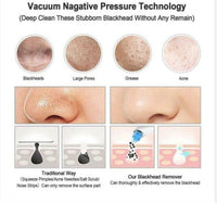 HKM-634643 Facial Pore Cleaner with Vacuum Suction for Acne and Skin Rejuvenation