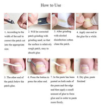 HKM-629779 Ingrown Toenail Correction Patch for Healthy Nail Growth and Pain Relief