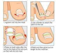 HKM-629779 Ingrown Toenail Correction Patch for Healthy Nail Growth and Pain Relief