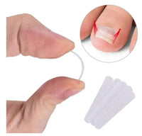 HKM-629779 Ingrown Toenail Correction Patch for Healthy Nail Growth and Pain Relief