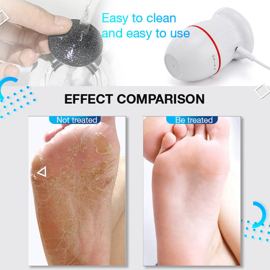 HKM-770323 Rechargeable Electric Foot Grinder for Removing Dead Skin and Calluses
