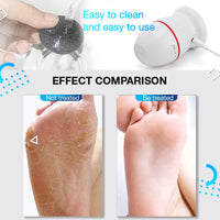 HKM-770323 Rechargeable Electric Foot Grinder for Removing Dead Skin and Calluses