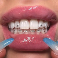 HKM-571987 Sparkling Tooth Rhinestones and Crystal Tooth Gems for Dazzling Smile Enhancement