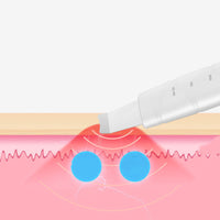 HKM-443155 Ultrasonic Facial Cleansing Instrument for Deep Pore Cleansing and Moisturizing
