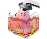 HKM-391763 Microcurrent Optical Fiber Body Device for Cellulite Reduction and Skin Rejuvenation