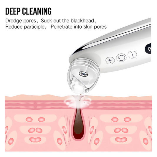 HKM-557267 Effective Blackhead Remover with Adjustable Suction Speed and Built-in LED Light