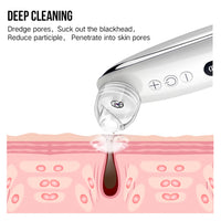 HKM-557267 Effective Blackhead Remover with Adjustable Suction Speed and Built-in LED Light