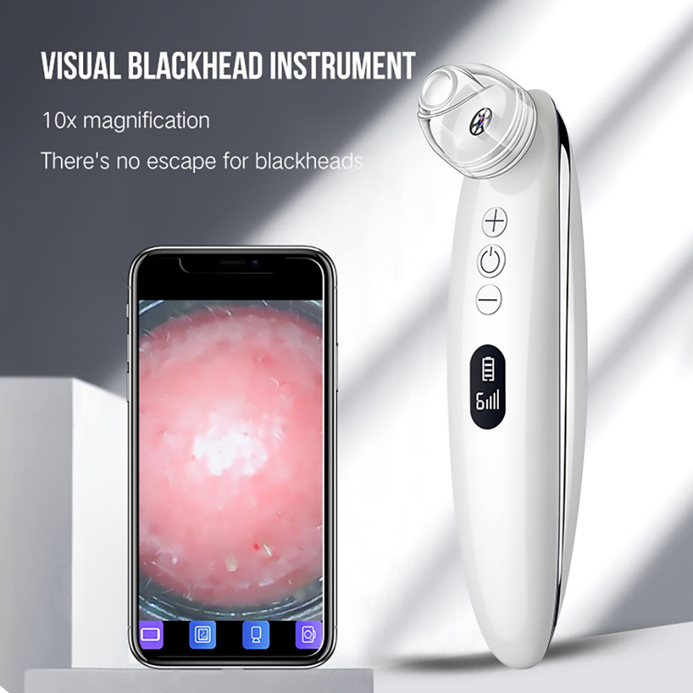 HKM-557267 Effective Blackhead Remover with Adjustable Suction Speed and Built-in LED Light