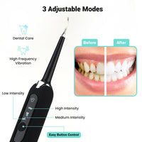 HKM-020627 Portable 3-Gear Oral Cleaning Tool with Ultrasonic Vibration and Four Cleaning Heads