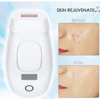 HKM-590675 Whole Body Laser Hair Removal Device with WPL Technology and 600,000 Lifespan