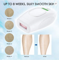HKM-590675 Whole Body Laser Hair Removal Device with WPL Technology and 600,000 Lifespan