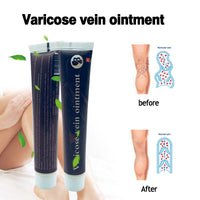 HKM-427987 Nursing Vein Cream, 20g - Soothing Formula for Varicose Veins