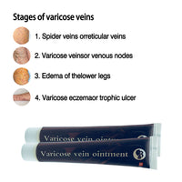 HKM-427987 Nursing Vein Cream, 20g - Soothing Formula for Varicose Veins