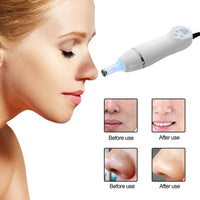 HKM-458963 Electric Blackhead Remover with 3 Suction Nozzles and Microcrystalline Heads for Deep Pore Cleansing