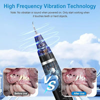 HKM-924115 Ultrasonic Dental Plaque and Tartar Remover for Dogs - Complete Tooth Cleaning Set