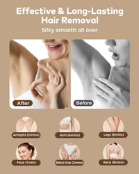 HKM-908819 Premium Hair Removal Device for Smooth Skin