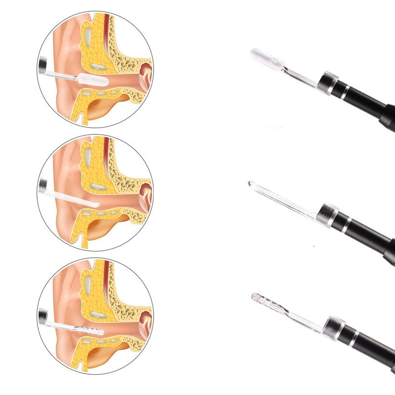 HKM-104531 5.5mm Three-in-One Ear Endoscope with LED Lighting and 1m Waterproof Design