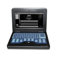 HKM-184723 Portable Digital Ultrasound Scanner with 3.5 Convex Probe for Comprehensive Diagnostic Imaging
