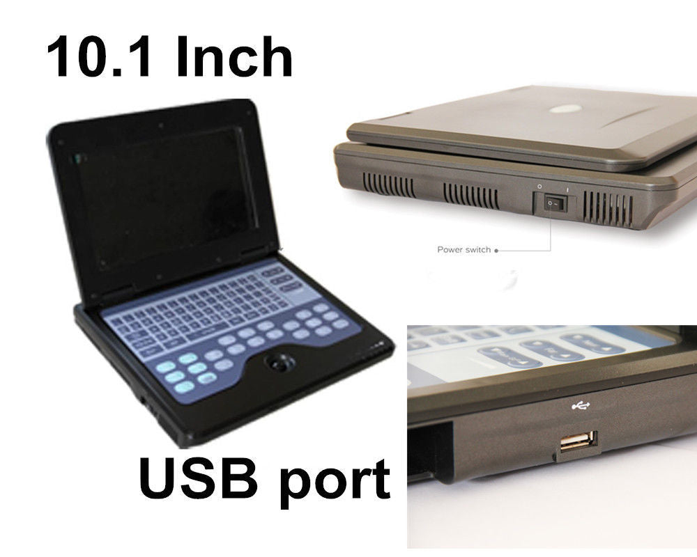 HKM-184723 Portable Digital Ultrasound Scanner with 3.5 Convex Probe for Comprehensive Diagnostic Imaging