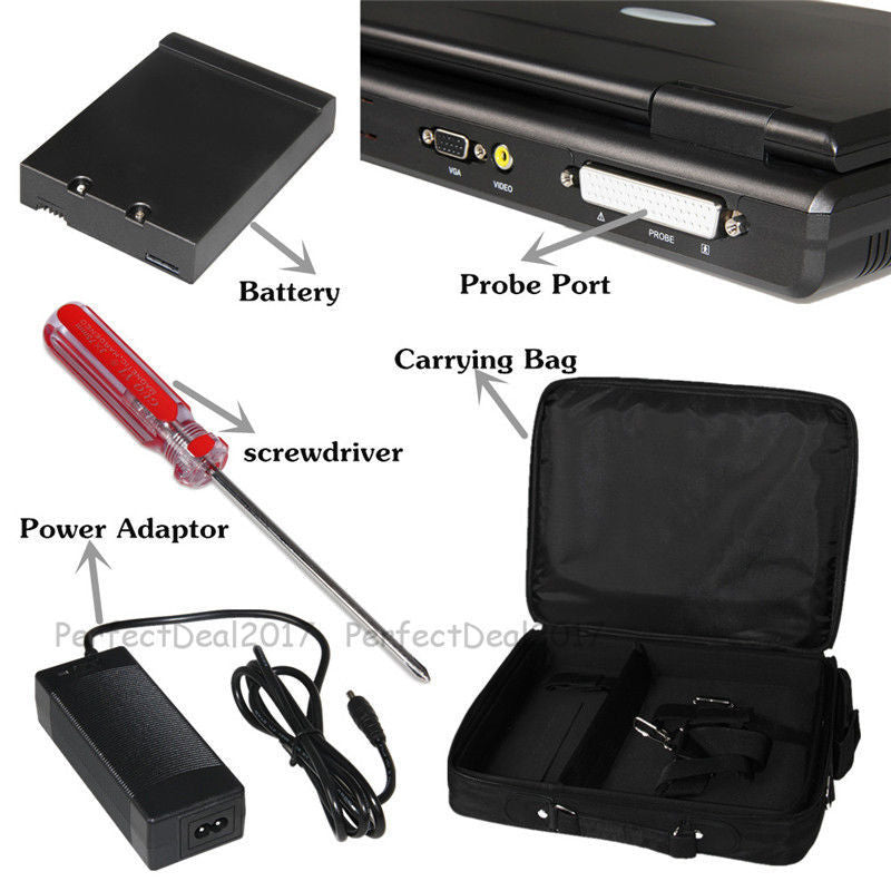 HKM-184723 Portable Digital Ultrasound Scanner with 3.5 Convex Probe for Comprehensive Diagnostic Imaging