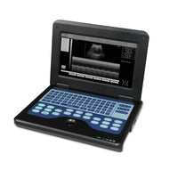 HKM-184723 Portable Digital Ultrasound Scanner with 3.5 Convex Probe for Comprehensive Diagnostic Imaging