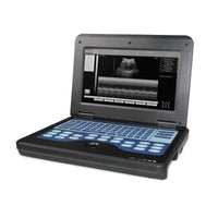 HKM-184723 Portable Digital Ultrasound Scanner with 3.5 Convex Probe for Comprehensive Diagnostic Imaging